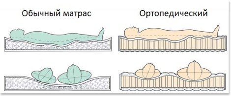 Rozdíl matrací