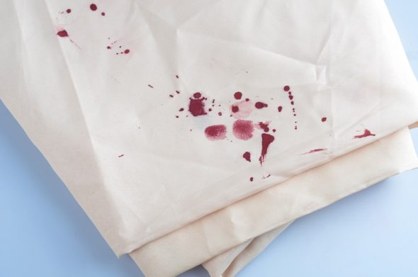 Macchie di sangue sui vestiti